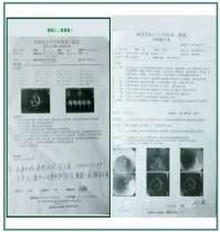 大国医者 国医名师 优秀中医传承人——杨宗仙